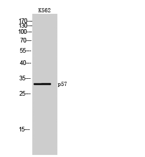Anti-p57 Antibody