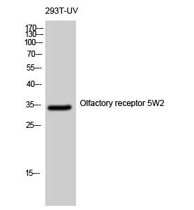 Anti-Olfactory receptor 5W2 Antibody
