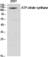 Anti-ATP-citrate synthase Antibody Anti-ATP-citrate synthase Antibody