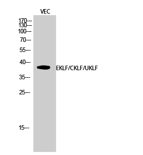Anti-EKLF / CKLF / UKLF Antibody