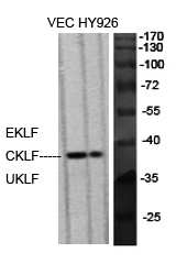 Anti-EKLF / CKLF / UKLF Antibody Anti-EKLF / CKLF / UKLF Antibody