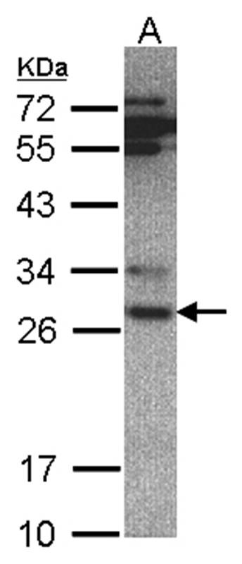 Anti-20S Proteasome alpha 6 Antibody