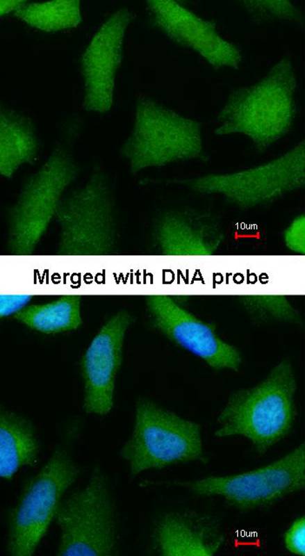 Anti-20S Proteasome alpha 6 Antibody Anti-20S Proteasome alpha 6 Antibody