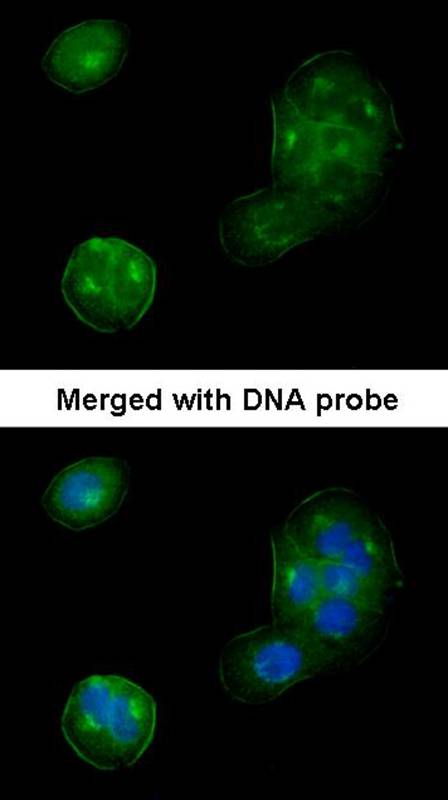 Anti-Thrombomodulin (CD141) Antibody Anti-Thrombomodulin (CD141) Antibody