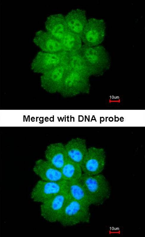 Anti-Bcl-2-like protein 12 Antibody Anti-Bcl-2-like protein 12 Antibody