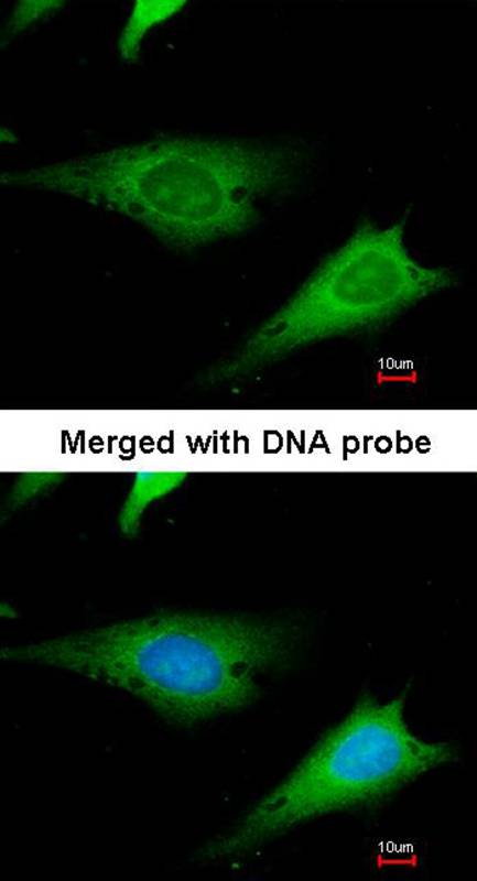 Anti-ribosomal protein S3a Antibody Anti-ribosomal protein S3a Antibody