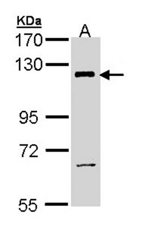 Anti-PI3 Kinase p110 beta Antibody