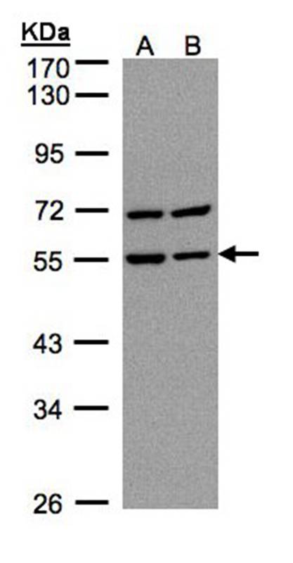 Anti-Carbonic anhydrase 9 Antibody