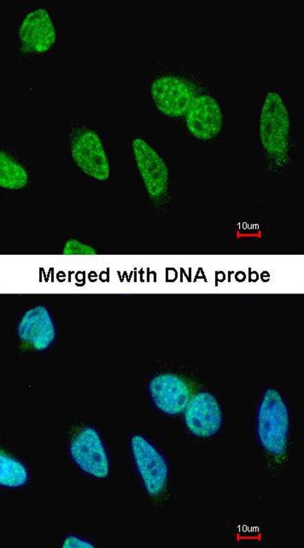 Anti-Carbonic anhydrase 9 Antibody Anti-Carbonic anhydrase 9 Antibody