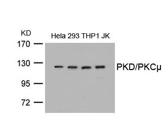 Anti-PKD / PKCm (Ab-738) Antibody