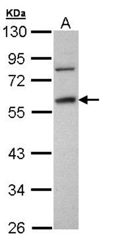 Anti-Fibrinogen gamma Antibody
