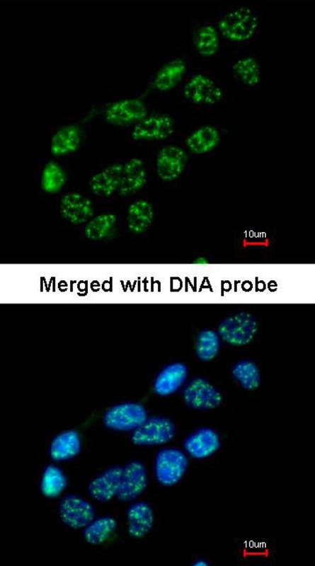 Anti-nucleoporin p62 Antibody Anti-nucleoporin p62 Antibody