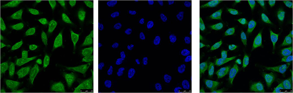 Anti-HSP70 Antibody