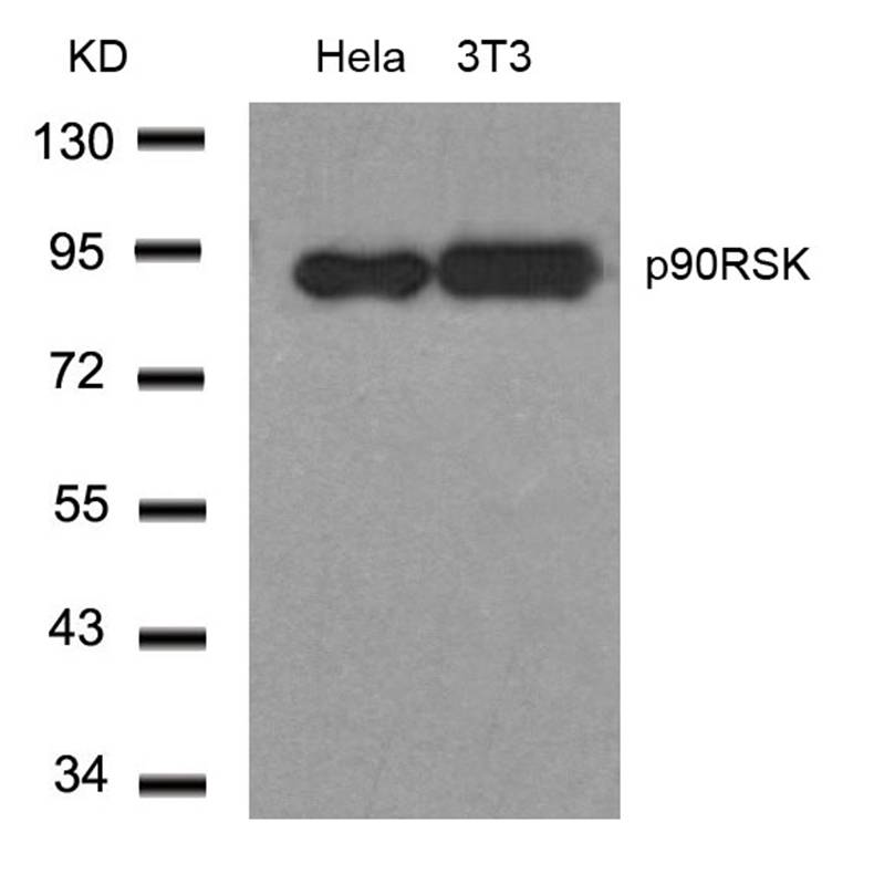 Anti-p90RSK (Ab-348) Antibody