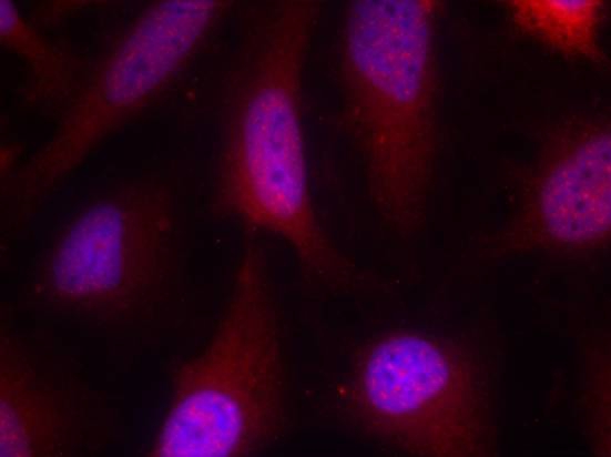 Anti-p90RSK (Ab-348) Antibody Anti-p90RSK (Ab-348) Antibody