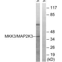 Anti-MAP2K3 (Ab-222) Antibody