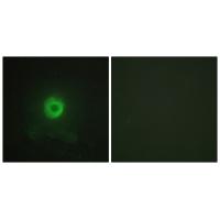 Anti-TNF Receptor II Antibody Anti-TNF Receptor II Antibody