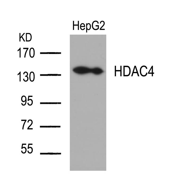 Anti-HDAC4 (Ab-632) Antibody