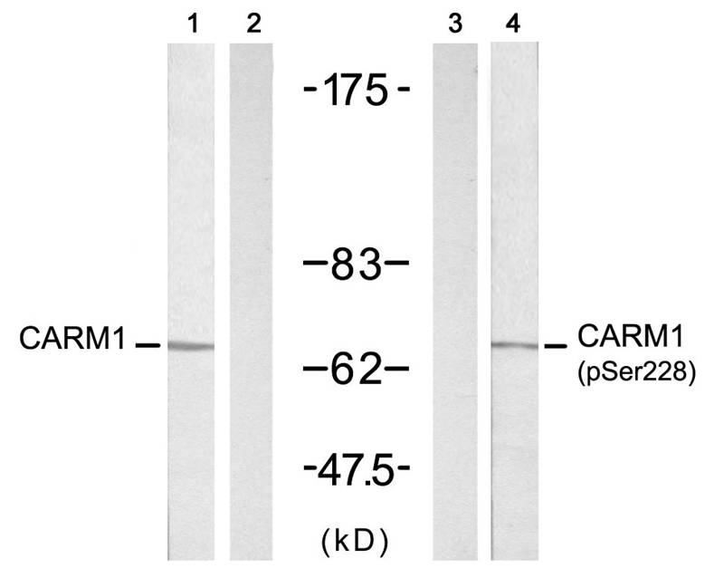 Anti-CARM1 (Ab-228) Antibody