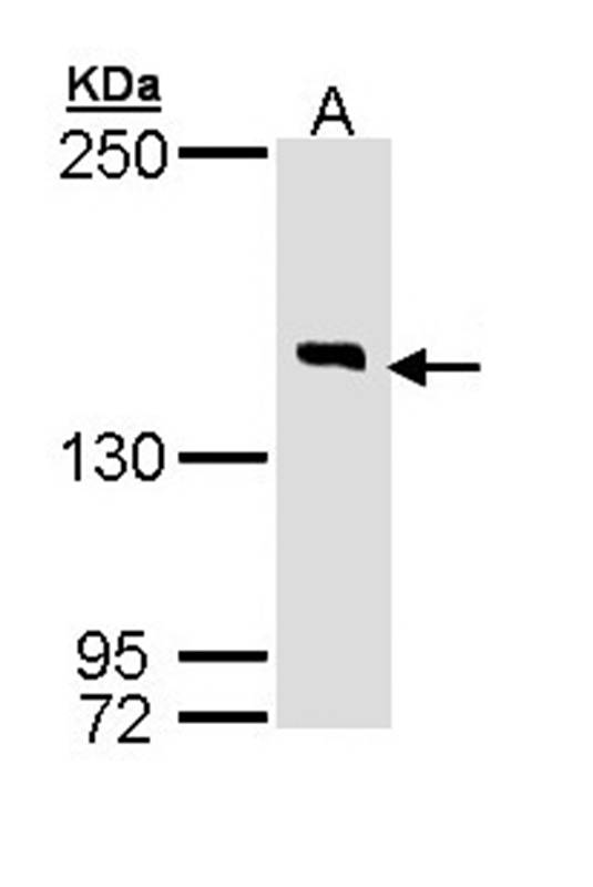 Anti-DIP2 homolog B Antibody