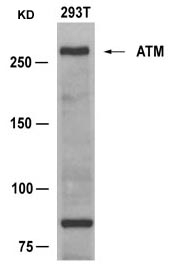 Anti-ATM (Ab-1981) Antibody
