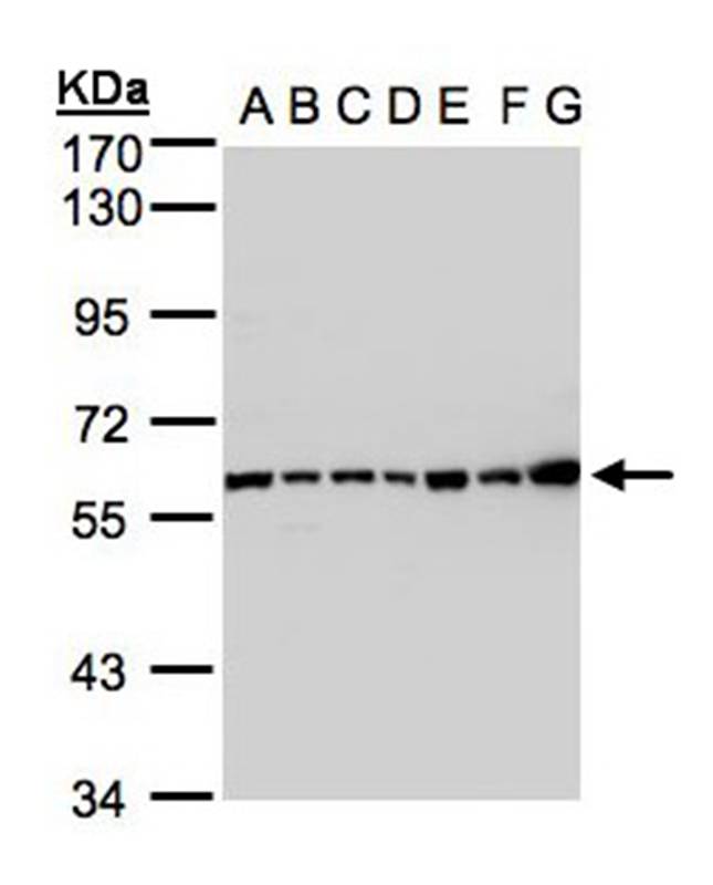 Anti-Complement C2 Antibody
