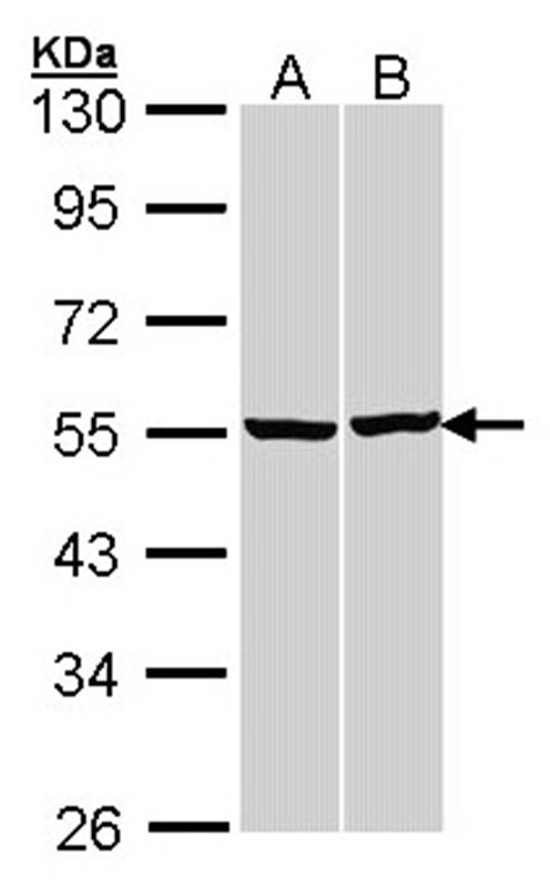 Anti-beta Tubulin Antibody
