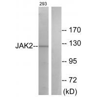 Anti-JAK2 (Ab-570) Antibody
