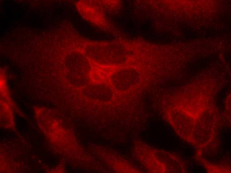 Anti-Bcr (Ab-177) Antibody Anti-Bcr (Ab-177) Antibody