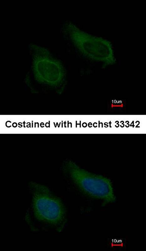 Anti-NNT-1 / BSF-3 Antibody Anti-NNT-1 / BSF-3 Antibody