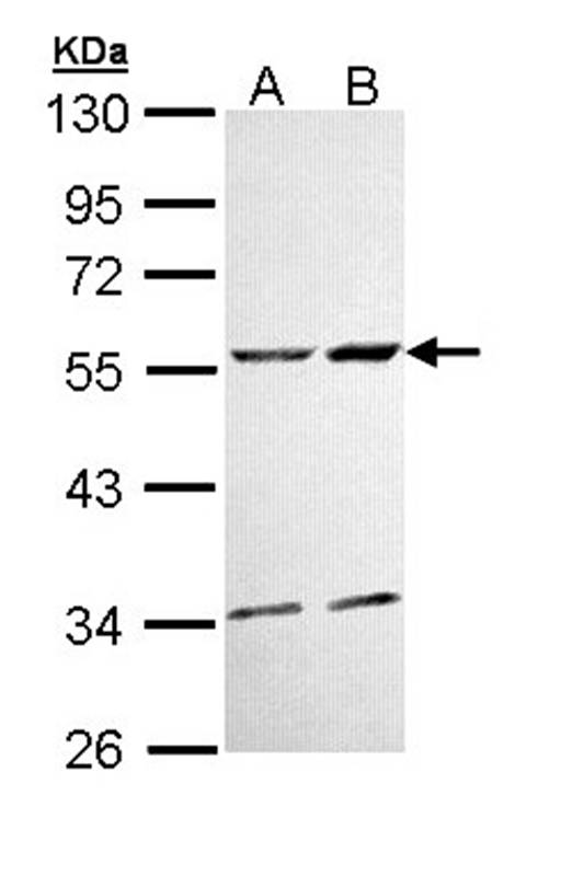 Anti-CaMKII delta Antibody
