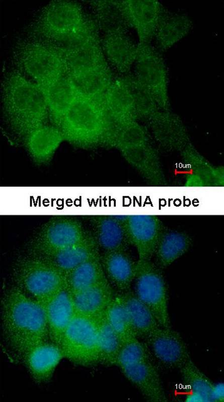 Anti-CaMKII delta Antibody Anti-CaMKII delta Antibody