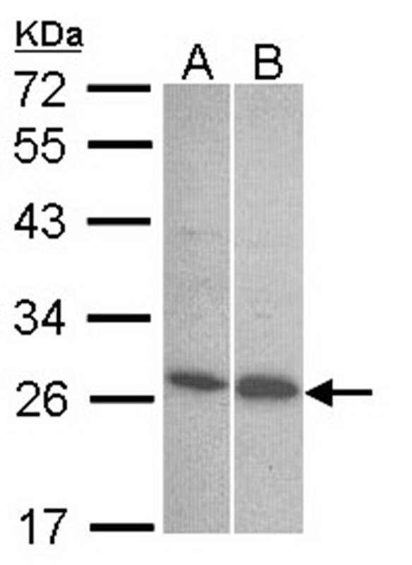 Anti-Endothelin 1 Antibody