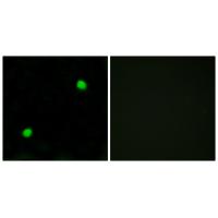 Anti-Histone H2AX Antibody Anti-Histone H2AX Antibody