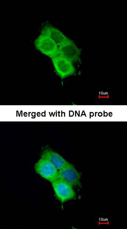 Anti-OXSR1 (OSR1) Antibody Anti-OXSR1 (OSR1) Antibody