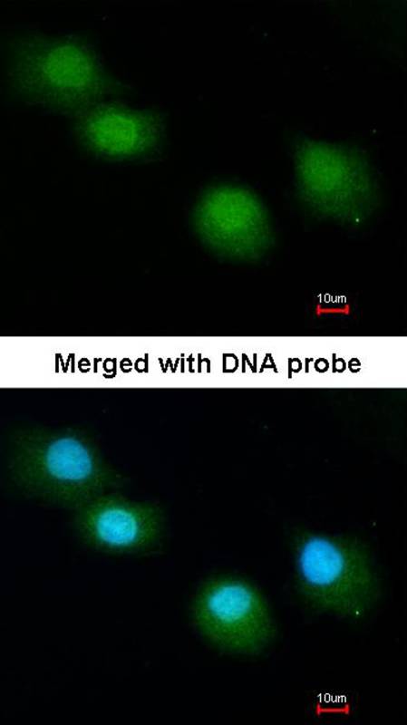 Anti-Ubiquilin-1 Antibody Anti-Ubiquilin-1 Antibody