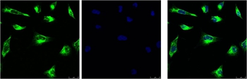 Anti-Vimentin (1A7) Antibody Anti-Vimentin (1A7) Antibody