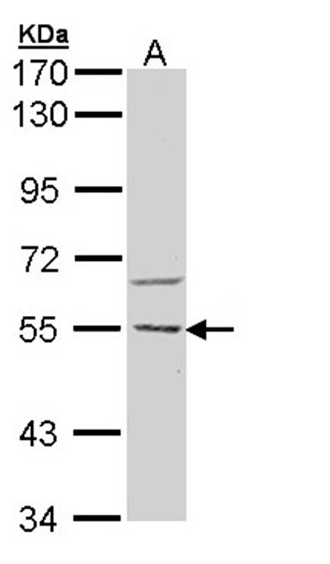 Anti-CaMKK beta Antibody