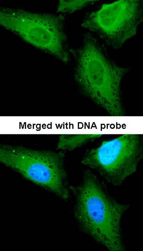 Anti-CaMKK beta Antibody Anti-CaMKK beta Antibody