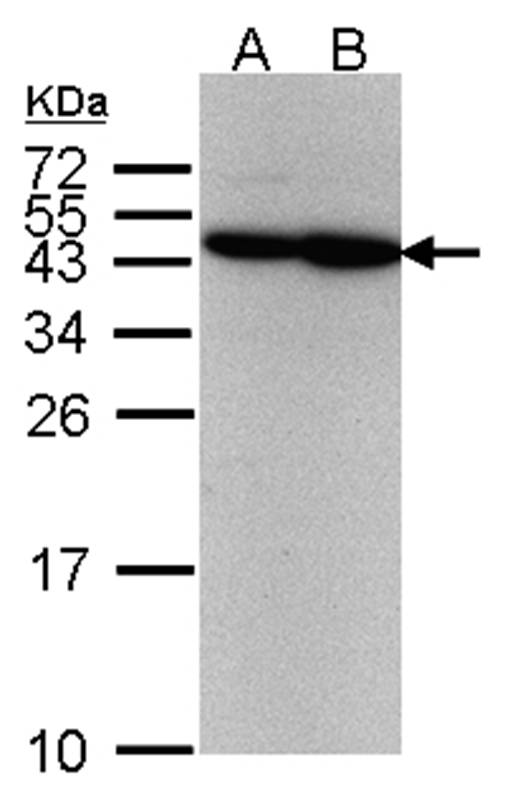 Anti-ERCC8 (CSA) Antibody
