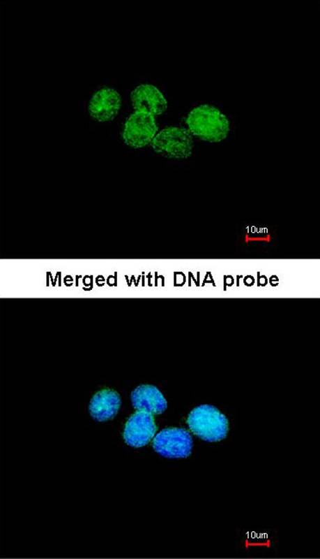 Anti-ERCC8 (CSA) Antibody Anti-ERCC8 (CSA) Antibody