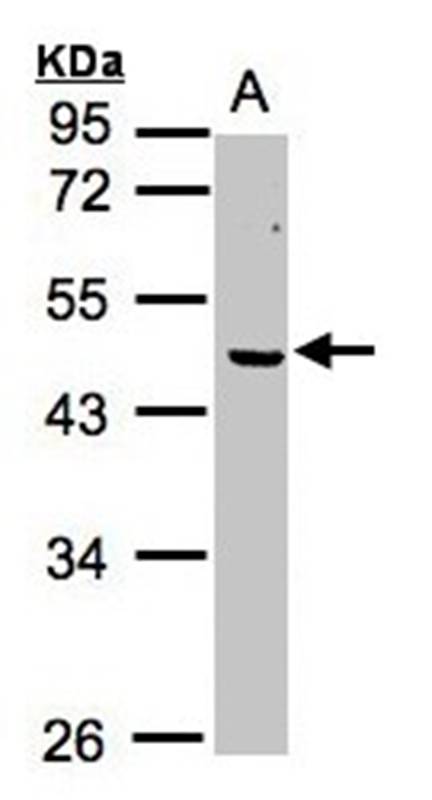 Anti-ERCC8 (CSA) Antibody