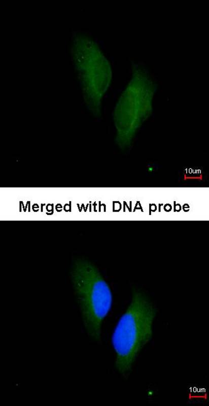Anti-Protein S Antibody Anti-Protein S Antibody