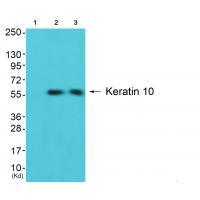 Anti-Keratin 10 Antibody Anti-Keratin 10 Antibody