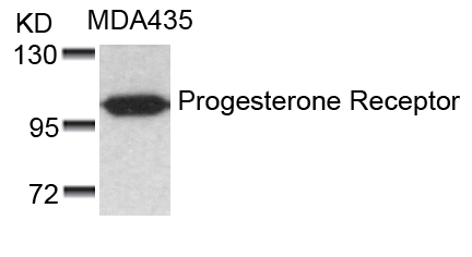 Anti-Progesterone Receptor (Ab-190) Antibody