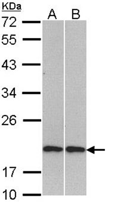 Anti-Cofilin 2 Antibody