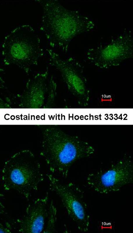 Anti-Calpain-5 Antibody Anti-Calpain-5 Antibody