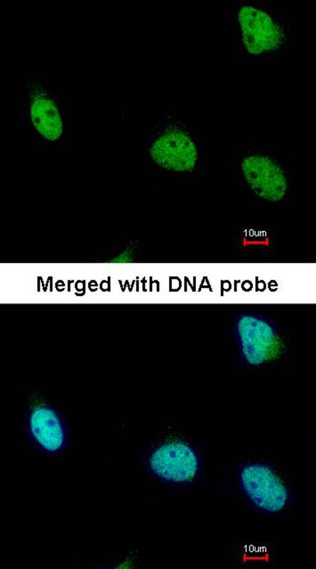 Anti-RSK1 p90 Antibody Anti-RSK1 p90 Antibody