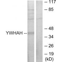 Anti-14-3-3 eta Antibody
