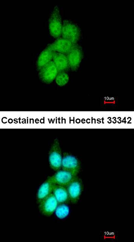 Anti-BAIAP2L1 Antibody Anti-BAIAP2L1 Antibody